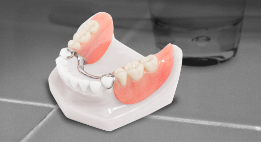 Tháo lắp cứng bán hàm